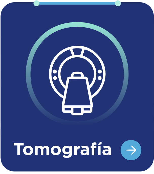 Tomografía